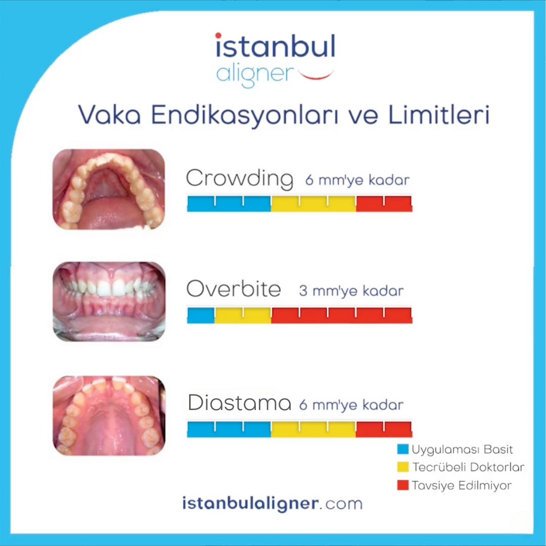 istanbulaligner's tweet image. İstanbul Aligner #Crowding, #Overbite, #Diastama vaka limitleri içerisinde mükemmel sonuçlar sunar.

📞 0 850 346 5884
🌐 istanbulaligner.com

#istanbulaligner #şeffafortodontiktedavi #şeffaftedavi #aligner#yeninesilteknoloji #şeffafgülüşler #diştedavisi