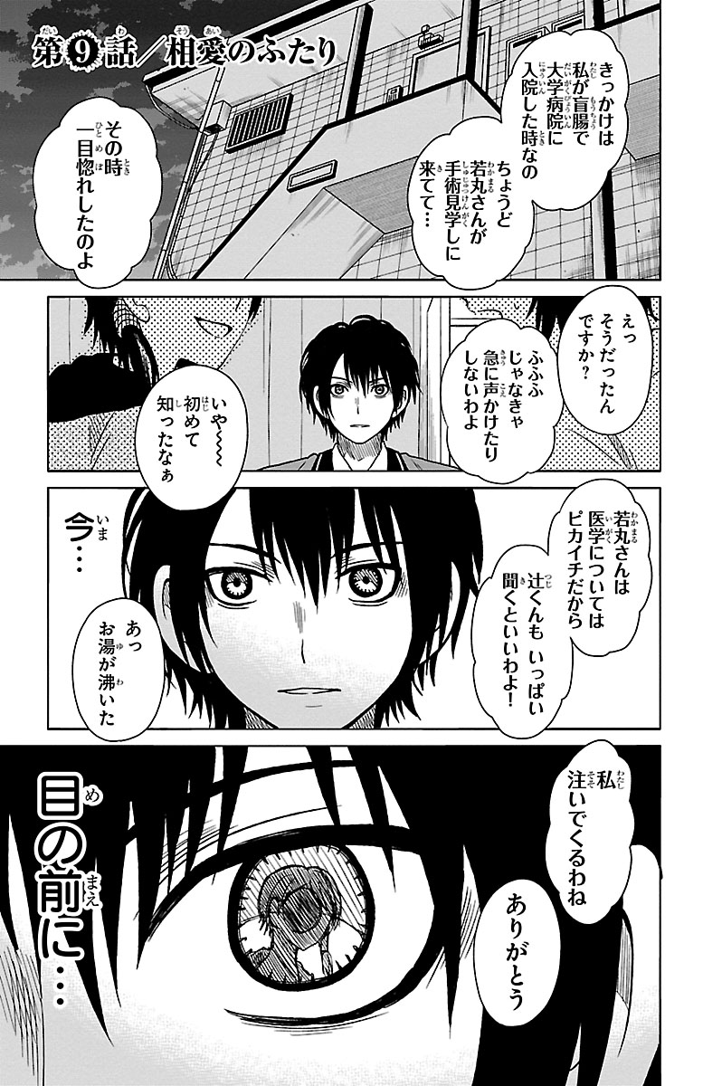 (1/9) 