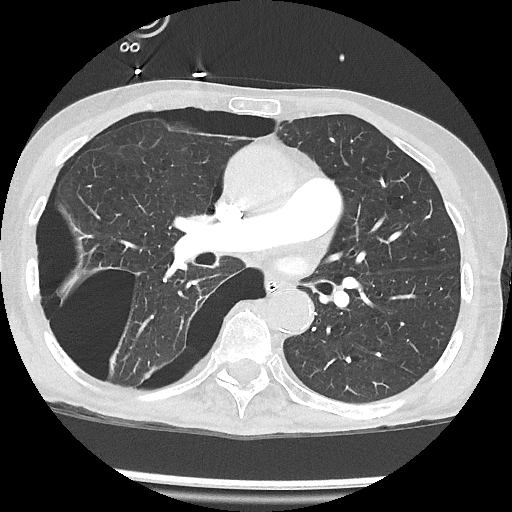 ICU REACH Newsletter (August 19, 2024) wix.to/esOfwWG