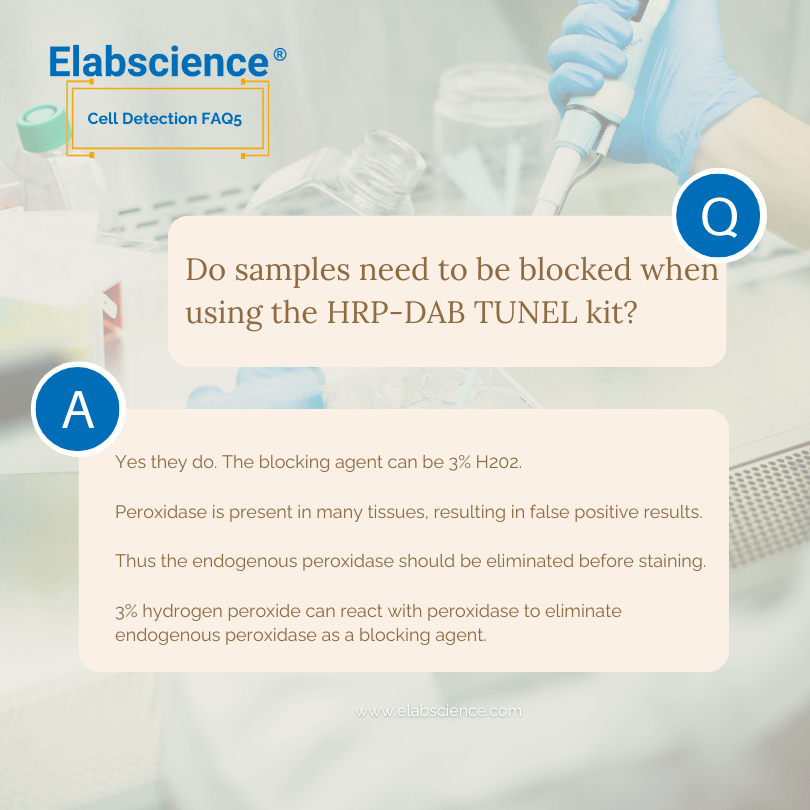 Elabscience_bio's tweet image. 📚 𝐂𝐞𝐥𝐥 𝐃𝐞𝐭𝐞𝐜𝐭𝐢𝐨𝐧 𝐅𝐀𝐐𝟓
🙋‍♂️ Do samples need to be blocked when using the HRP-DAB TUNEL kit?
🔎 Check the answers below 👇

#celldetection #HRP #TUNEL #staining #Elabscience