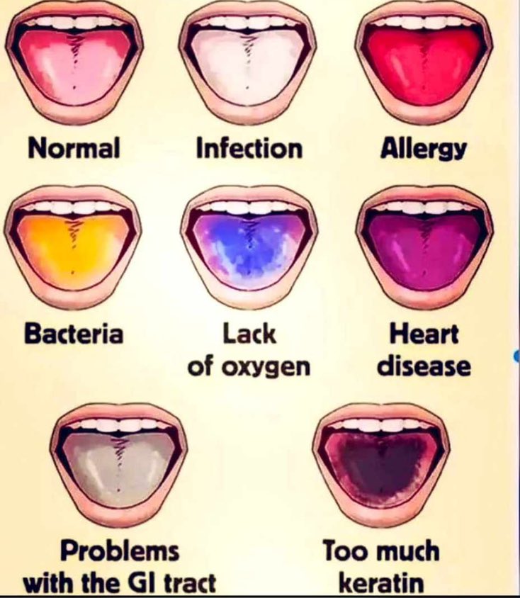 Ongod468's tweet image. #WHO #GHS #PSGH #GPC #GTV #TV3