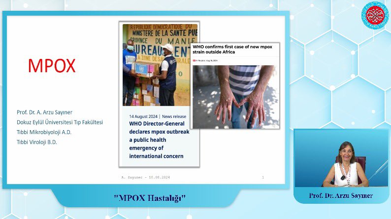 DEÜ Tıp Fakültesi Tıbbi Mikrobiyoloji Anabilim Dalı ve Viroloji Bilim Dalı Öğretim Üyemiz Prof. Dr. Ayça Arzu Sayıner MPOX hastalığı hakkında merak edilenleri bizlerle paylaştı. #deutıp #deutıp ##dokuzeylültıpfakültesi #dokuzeylültıp #Mpoxvirüsü #MPOX #Maymunçiçeği