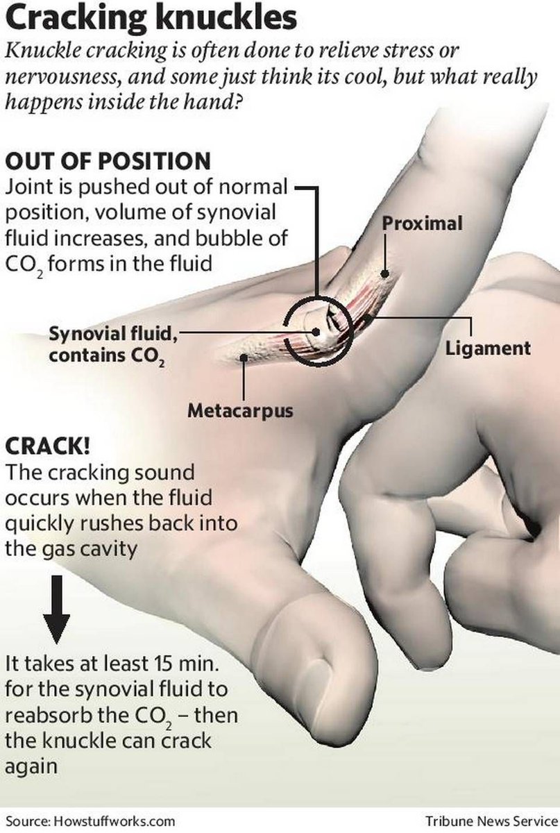 Let’s debunk a health myth.

Myth: Cracking knuckles causes arthritis.

Fact: There is no scientific evidence linking knuckle cracking to arthritis. 

Call or WhatsApp us on +233246747027 or on  our socials @diagnosticadepts

#HealthMythBusters #DiagnosticAdepts #HomeHealthcare