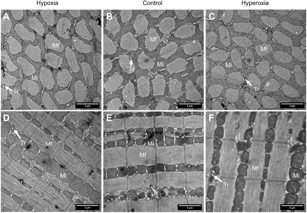 focalplane_jcs's tweet photo. It’s #EMmonday and we’re looking at moth flight muscle by TEM. @sarawilmsen and Edward Dzialowski find no major differences in morphometrics of flight muscle of M. sexta raised in hypoxia, normoxia or hyperoxia.
📖@J_Exp_Biol  https://t.co/L166DGPtYU
https://t.co/plVT2uleXc https://t.co/nUXpYQ5SRn