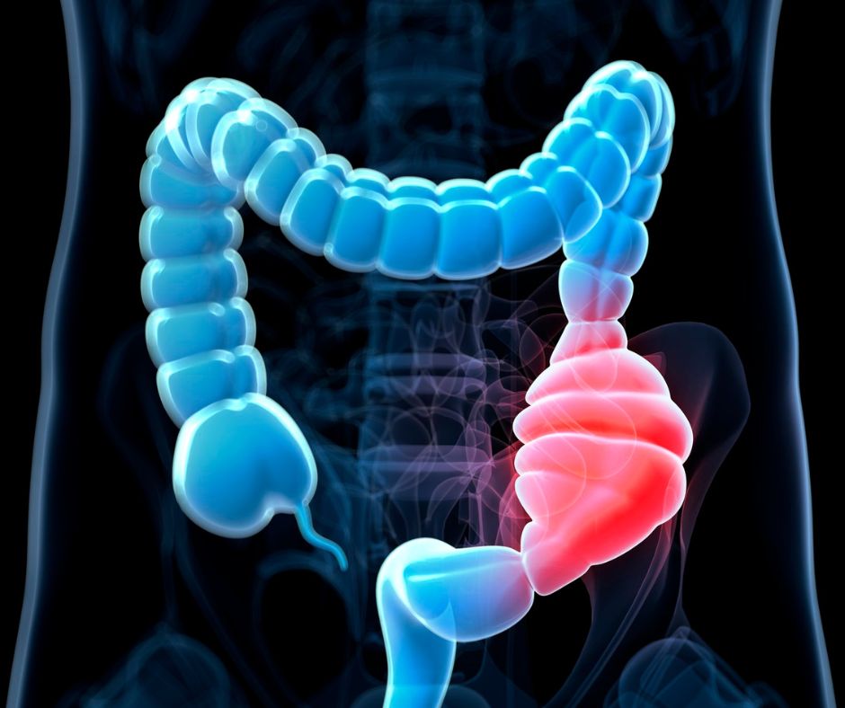 theholisticnick's tweet photo. Irregular bowel movements are common but often dismissed as no big deal.

This can be risky as it affects the entire body &amp; can lead to serious health issues.

Here are the most common causes I’ve seen and how I’ve helped people fix it.  

-- THREAD -- https://t.co/caBpW2BQgB