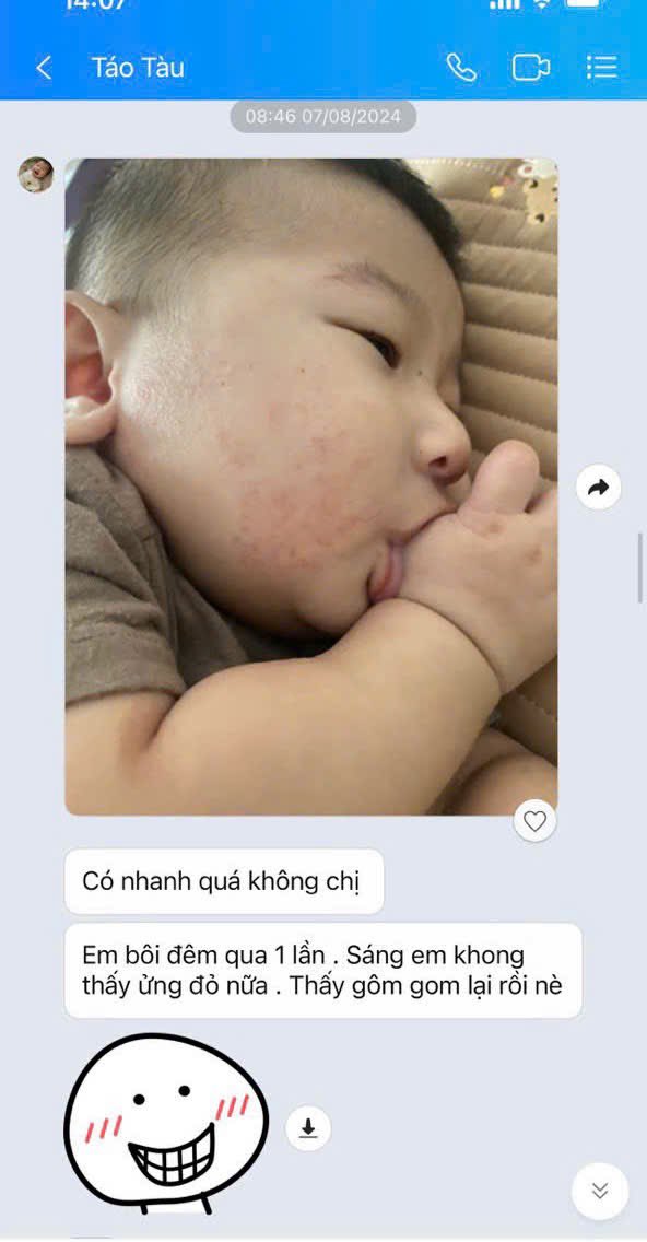 LinhAnh168's tweet photo. Bán được hàng vui 1 nhưng nhận được phản hồi như này vui gấp 10.
Bé bị chàm sữa bôi nhiều loại không khỏi, bôi kem mỡ trộm vía da láng mịn rồi.
#kemboidaminhhung
#kemmominhhung
#chamsua, #viemda #eczema https://t.co/MgonHAta5N