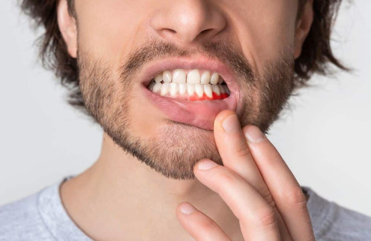 dentistnearyou's tweet image. Tooth Sensitivity: Just Needs Sensitive Toothpaste, Or Symptom of Bigger Problems? plazadental.com.au/tooth-sensitiv… #sensitiveteeth #toothsensitivity #toothpaste #mackay #mackaydentist
