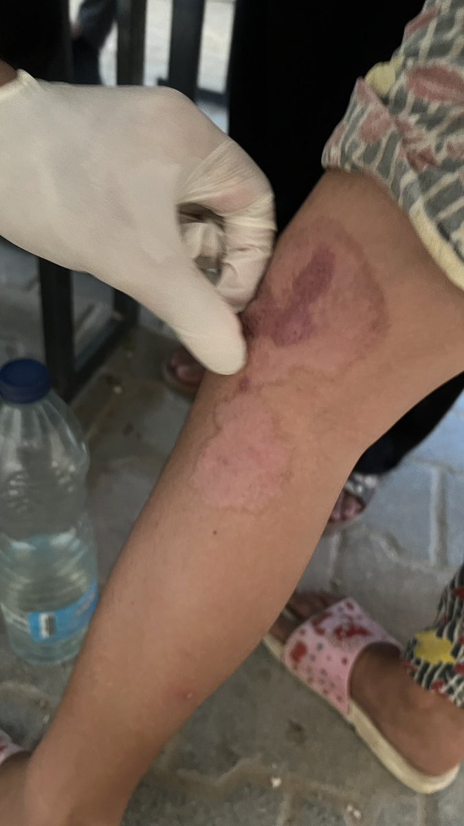 Gaza Wound Care tweet media
