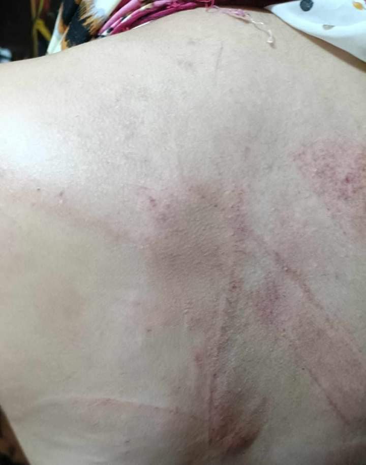 - بنت اسمها "زينه". من "المقطم". عندها 22 سنة بتشتغل وبتصرف على نفسها "قررت تخلع الحجاب". والدها وأخوها "حلقوا شعرها زيرو وتعرضت للتعذيب وخدوا فلوسها واللاب توب بتاعها". البنت عملت محضر امبارح بس لحد دلوقتي متمش القبض على المجرمين والبنت دلوقتي محتاجة تبقى في "أمان وسكن وشغل".