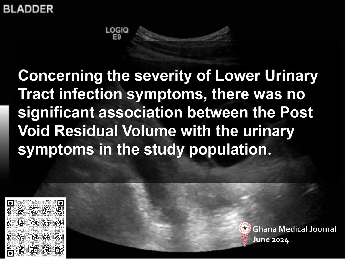 Ghana Medical Journal (@ghanamedj) on Twitter photo Correlation of sonographically-determined residual urine volume with lower urinary tract symptoms in adult males at a tertiary hospital
ghanamedj.org/articles/June2…
<a href="/GhanaMedAssoc/">Ghana Medical Association</a>
<a href="/ghanamedj/">Ghana Medical Journal</a>
<a href="/TheLancet/">The Lancet</a>
<a href="/AfricaCDC/">Africa CDC</a>
<a href="/AJPPEditors/">African Journals</a>
<a href="/WHOAFRO/">WHO African Region</a>
<a href="/ONEinAfrica/">ONE in Africa</a>
<a href="/IFRCAfrica/">IFRC Africa</a> Correlation of sonographically-determined residual urine volume with lower urinary tract symptoms in adult males at a tertiary hospital
ghanamedj.org/articles/June2…
<a href="/GhanaMedAssoc/">Ghana Medical Association</a>
<a href="/ghanamedj/">Ghana Medical Journal</a>
<a href="/TheLancet/">The Lancet</a>
<a href="/AfricaCDC/">Africa CDC</a>
<a href="/AJPPEditors/">African Journals</a>
<a href="/WHOAFRO/">WHO African Region</a>
<a href="/ONEinAfrica/">ONE in Africa</a>
<a href="/IFRCAfrica/">IFRC Africa</a>