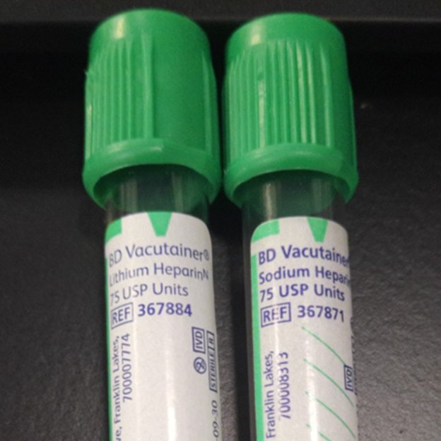 Jonathan Cohen MD, MS, FASA, CPPS (@jonathancohenmd) on Twitter photo We talk about #lookalike vials in #anesthesia. What about #lookalike tubes??
We have both of these & use them in different POC testing devices in the OR. Thanks to Dr. Mayrin Correa Medina for showing me this
Also check out <a href="/ClinChemMD/">David N. Alter MPH MD DABCC๐งฌ</a>'s post: x.com/ClinChemMD/staโฆ
<a href="/APSForg/">APSF</a> We talk about #lookalike vials in #anesthesia. What about #lookalike tubes??
We have both of these & use them in different POC testing devices in the OR. Thanks to Dr. Mayrin Correa Medina for showing me this
Also check out <a href="/ClinChemMD/">David N. Alter MPH MD DABCC๐งฌ</a>'s post: x.com/ClinChemMD/staโฆ
<a href="/APSForg/">APSF</a>