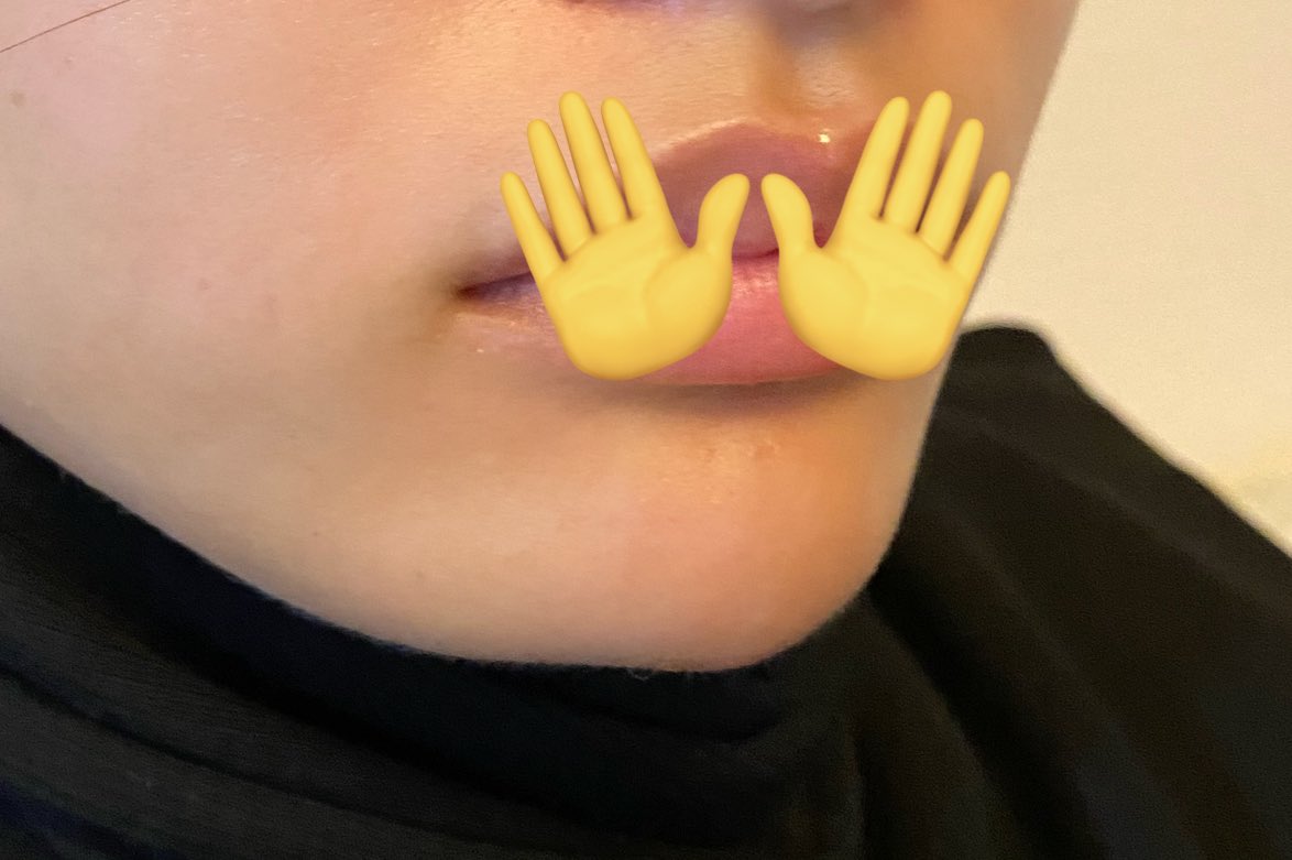 knprksera's tweet photo. 顎ヒアル下手すぎて笑っちゃう😂ちっちゃいv作ってくれた😂笑笑 https://t.co/QoIenqjkYt