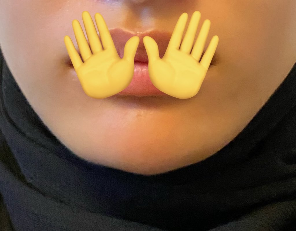 knprksera's tweet photo. 顎ヒアル下手すぎて笑っちゃう😂ちっちゃいv作ってくれた😂笑笑 https://t.co/QoIenqjkYt