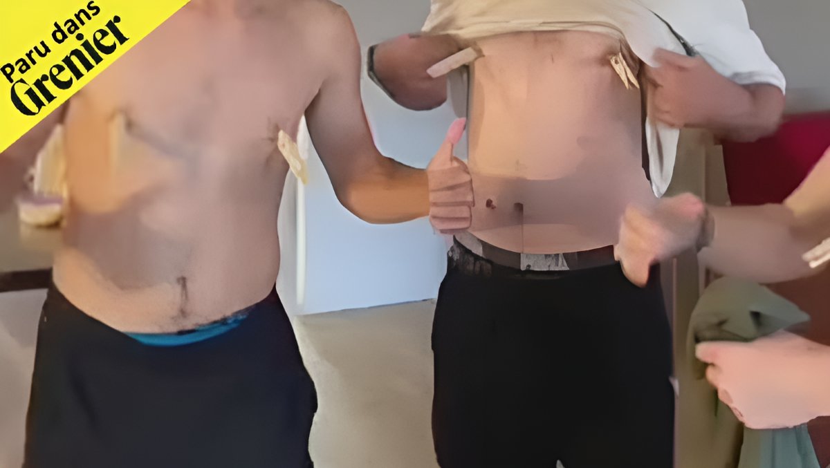 Initiations dans les universités et les équipes sportives : l’acceptabilité sociale est de plus en plus fermée. 

Mais, quel message envoient les institutions ? Réponse ici➡➡ lnkd.in/eS7r8pSx