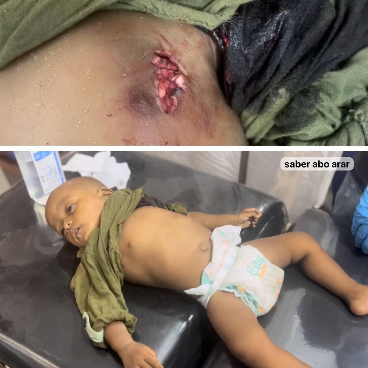 Kahraman mücahitlerle başedemeyen korkak siyonist askerler, intikamını bebeklerden alıyor..
📌 Gazze 
📸 19.08.2024