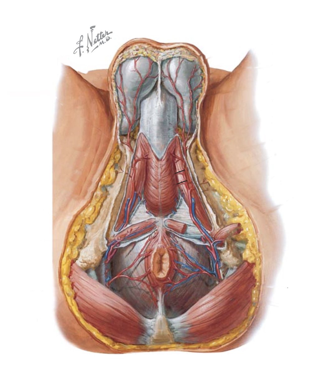 chica de uro✨ (@lachicadeuro) on Twitter photo Very great graphic explanation about decision making and different ways to acces the urethra during urethroplasty.
By Dr. Shreyas at 📍UROKUL during last Monthly Urethroplasty Workshop. Thank you so much!🙏🏽 <a href="/shreyasbhad/">Dr Shreyas Bhadranavar</a> 
#UroSoMe <a href="/sanjaybkulkarni/">Dr Sanjay Kulkarni</a> <a href="/drjoshi_pankaj/">Pankaj M Joshi</a> Very great graphic explanation about decision making and different ways to acces the urethra during urethroplasty.
By Dr. Shreyas at 📍UROKUL during last Monthly Urethroplasty Workshop. Thank you so much!🙏🏽 <a href="/shreyasbhad/">Dr Shreyas Bhadranavar</a> 
#UroSoMe <a href="/sanjaybkulkarni/">Dr Sanjay Kulkarni</a> <a href="/drjoshi_pankaj/">Pankaj M Joshi</a>