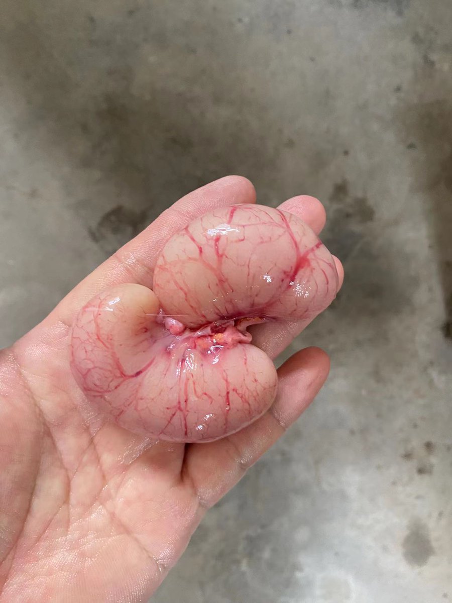 jiangjunshizu1's tweet photo. 摸了一下自己的居然没有这个大！唉，30+了！我也不知道是不是我的？唉 https://t.co/tavMgRLH7x