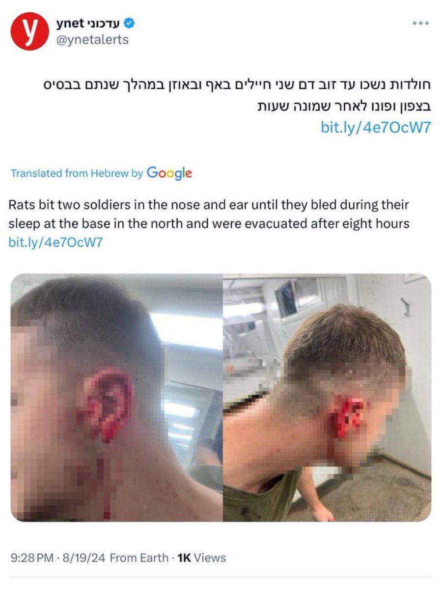 TheSaviour's tweet photo. 🚨#BREAKING: A group of RATS attacked 2 Israeli soldiers during their sleep leaving them to BLEED OUT for 8 HOURS until they were FINALLY rescued!

Source @propvstruth https://t.co/aCGBIhRb6l