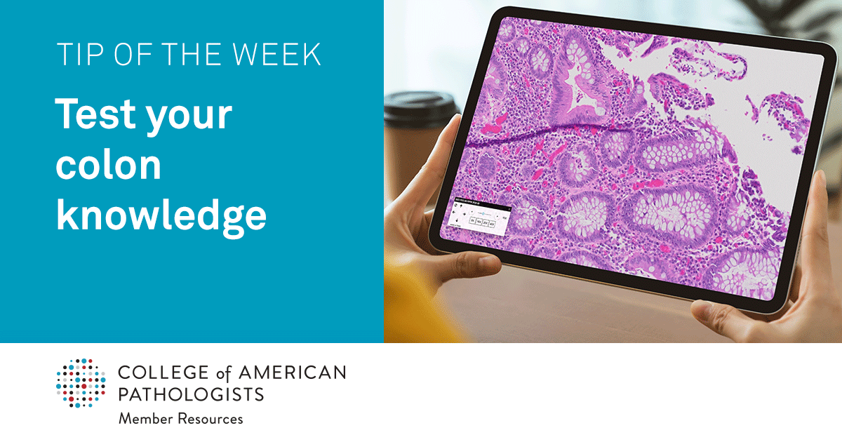 Pathologists's tweet photo. Keep your skills sharp and check what you know about diagnosis of the colon using a digital image and reading more about the case of the month. 

Learn more: https://t.co/CilmtntTNY https://t.co/OJdEUWwYHV