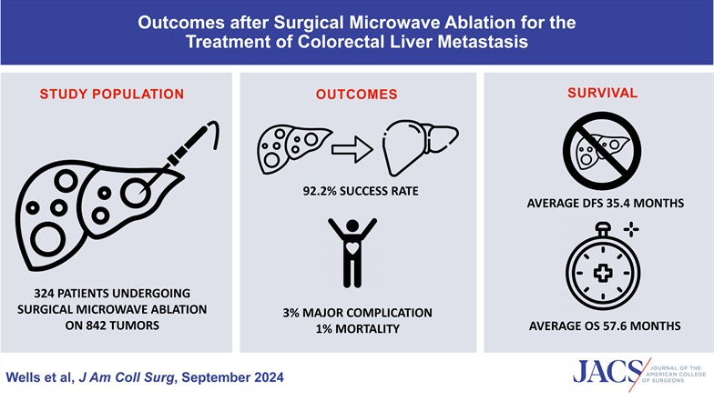 Surgical microwave ablation offers a low-morbidity approach to treatment of colorectal liver metastasis, with low rate of failure.

Read at: journals.lww.com/journalacs/ful…