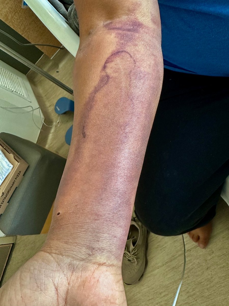 HeartToSubmit's tweet photo. Day 19 in the Hospital...Read the update on Glen White here on our #gofundme page and please share this post via social media, text or email with everyone you know https://t.co/FeSfjAIQ9G https://t.co/TYZiHmo4On