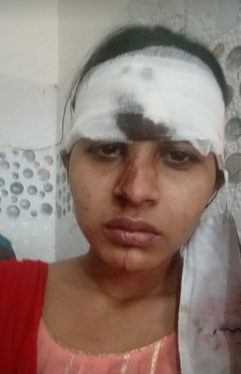 GhazalSaikh's tweet photo. Nangloi thana meri koi madad nahi kar raha, pehle FIR nhi li gyi, jab FIR  kiya gya tabse ulta mujhe or meri family ko torcher kiya jaa raha, pehle to apradhi ne mere behan ko itna mara uske kandhe Tod diya sar faar diya, har din rape ki dhmki mil rhi mujhe.a https://t.co/saczuk05Tm