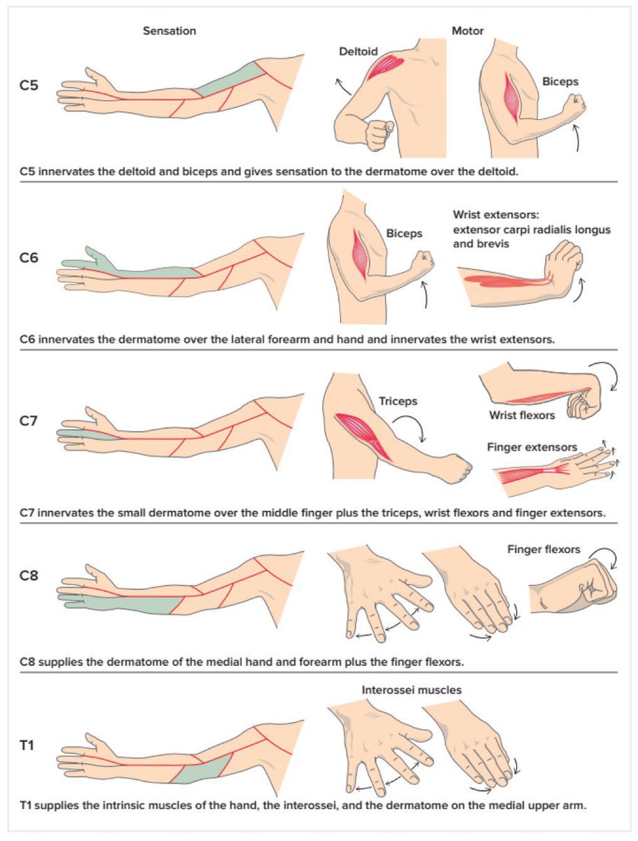 adfurlan's tweet photo. Sensory and Motor exam of the Upper Extremity

#cervical #radiculopathy #dermatomes #myotomes #neurologicalexam #MedTwitter 

Watch my YouTube video to learn more about Cervical Radiculopathy  👉🏻 https://t.co/dFMSILxNhw https://t.co/aYwYLupRFc