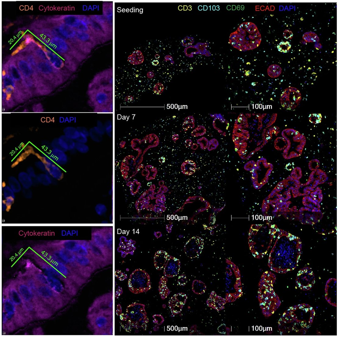 If you haven't already, then check out this <a href="/Nature/">nature</a> study from <a href="/IHB_Research/">Institute of Human Biology</a> scientists and their collaborators! ✅ 

They describe human intestinal immuno-#organoids as orchestrated by tissue-resident memory T cell-enriched transcriptomic programs governing cell motility and