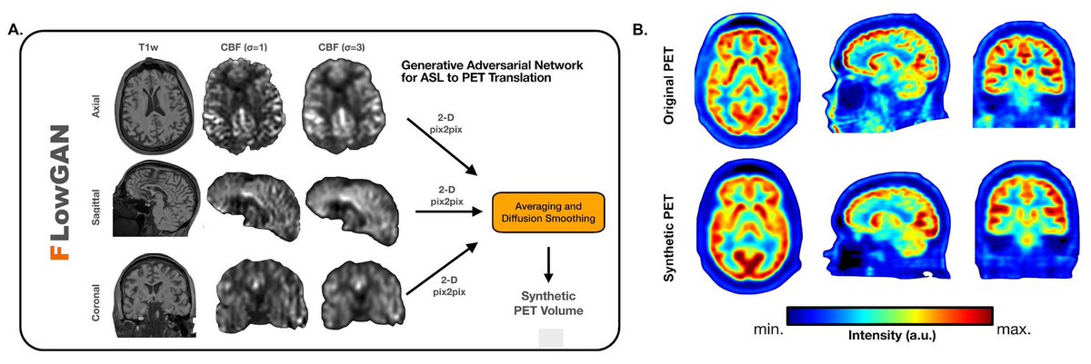 If you're at <a href="/theASFNR/">American Society of Functional Neuroradiology</a>, don't miss our talk on synthesizing PET-like images from ASL + T1w!
🧲➡️☢️

"Enhancing the Diagnostic Utility of ASL Imaging in Temporal Lobe Epilepsy through FLowGAN"

Presented by <a href="/alfrelucs/">Alfredo Lucas</a> in the #ASFNR24 Perfusion Session:
📅 Sat. 8/24
🕤 9-10 AM