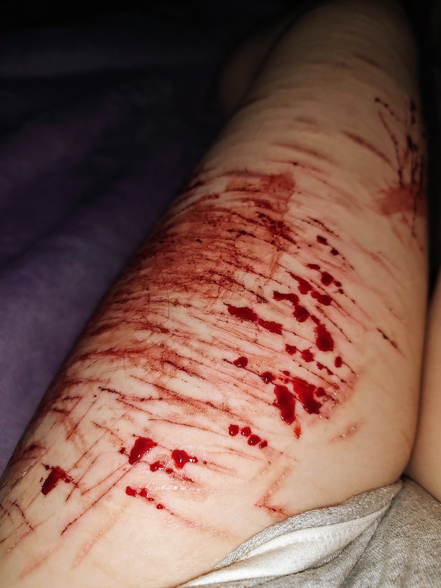 Asmo_Shtwt's tweet photo. Baby cuts~~
My blades have been super dull lately, but I'm happy :3 https://t.co/mnzaYv8UbO