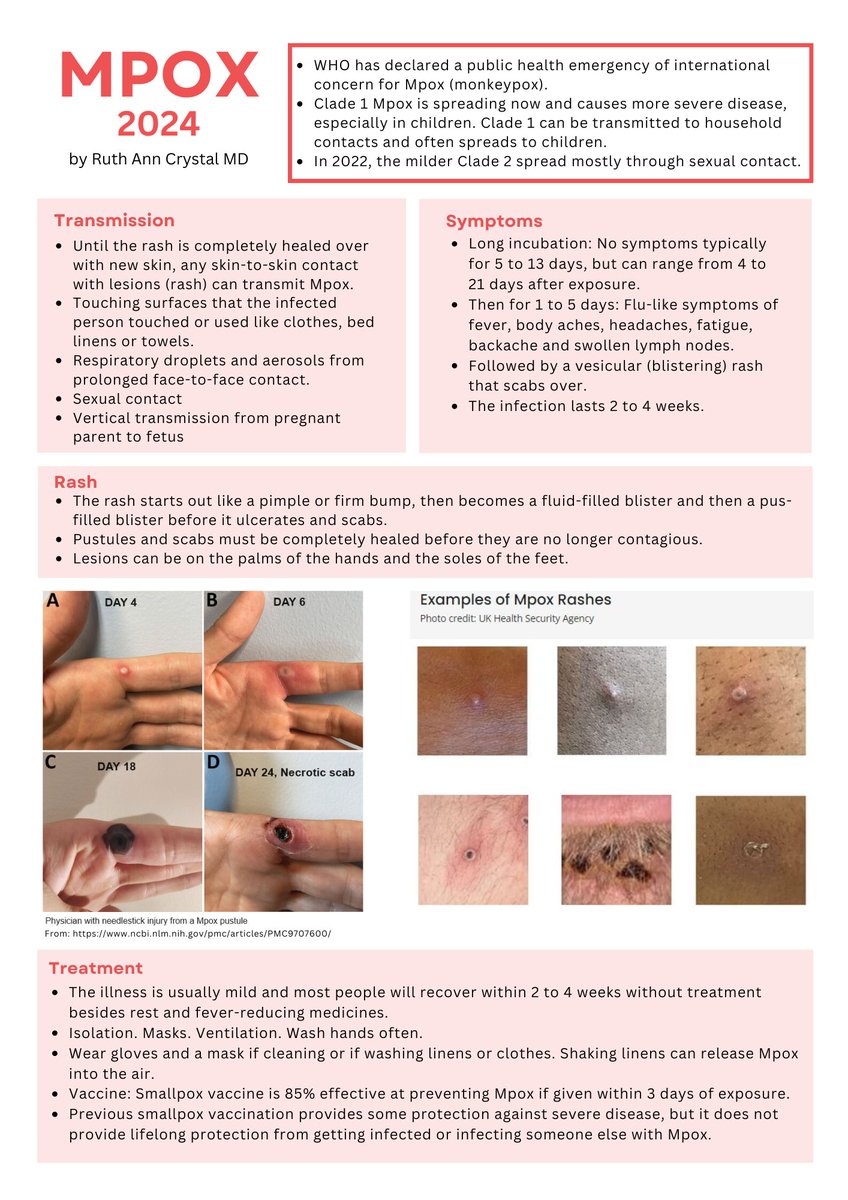 New infographic on #Mpox