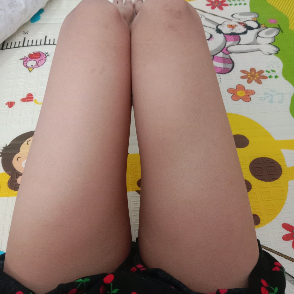 staaving4binnie's tweet photo. Why does my legs looks different my left leg looks smaller https://t.co/pnruASlinB
