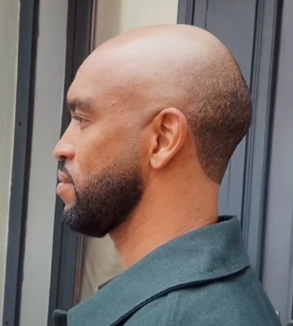 Nig_Farmer's tweet photo. #NaijaFarmerTips 

Are you bald headed or know anyone that's bald headed or is moving towards desert encroachment?

Do you need your hair back? 

Do you want to join the beard gangs and possibly connect your beards?

- Grate onions and extract the juice

 - Massage the juice into your scalp before bed

Alternatively, 

You can make a paste of onions juice, vodka and honey and apply before bed.

You might smell like suya but your hair will grow

You can unlock more hidden insights in nature by getting a copy of the Basic Home Remedies eBook for just #5000. Ready to buy? Visit https://t.co/1q1iGJAf1J