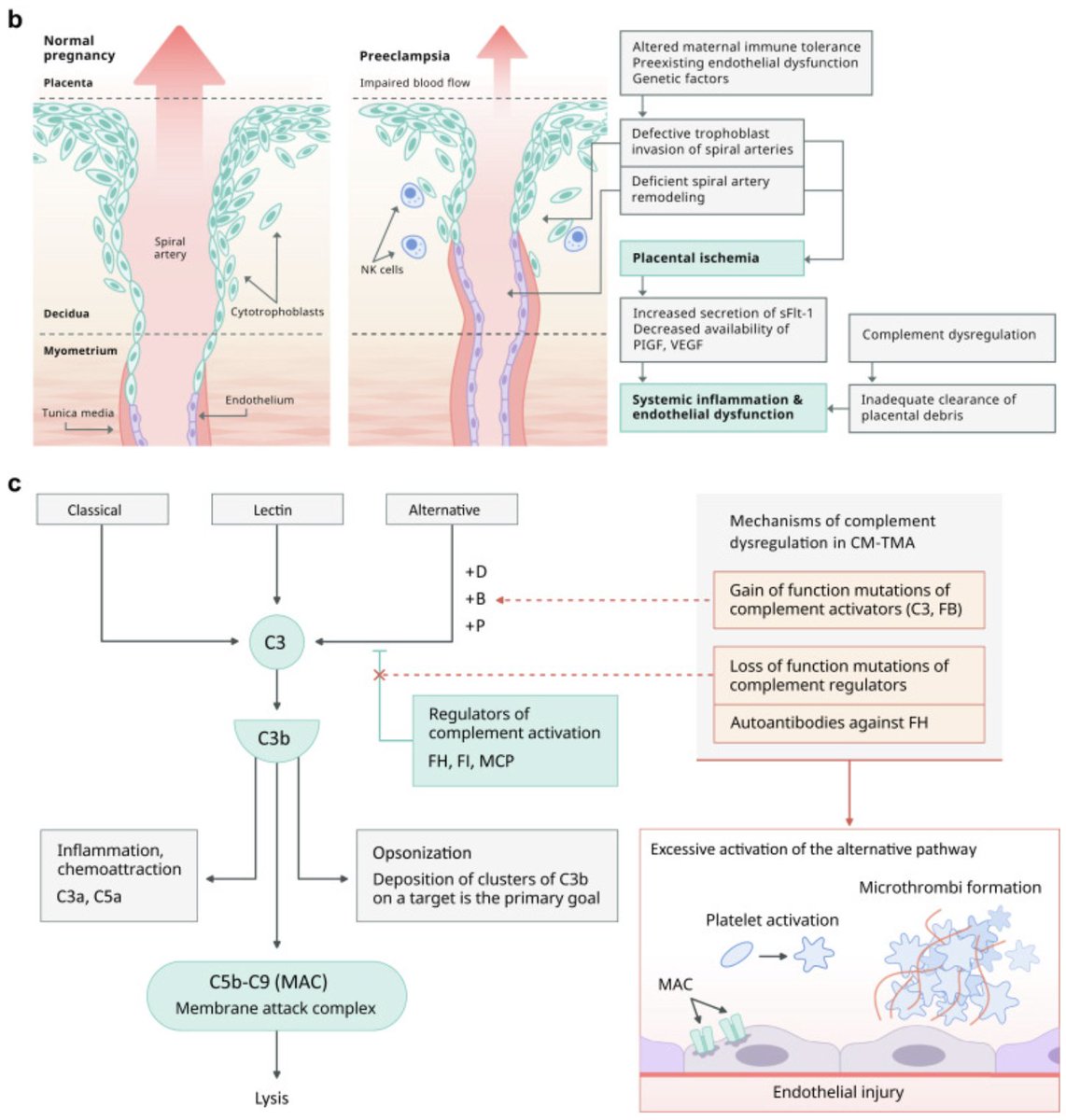 Thrombotic Microangiopathy in #Pregnancy: Current Understanding and Management Strategies

doi.org/10.1016/j.ekir…

#KIRReview #TMA