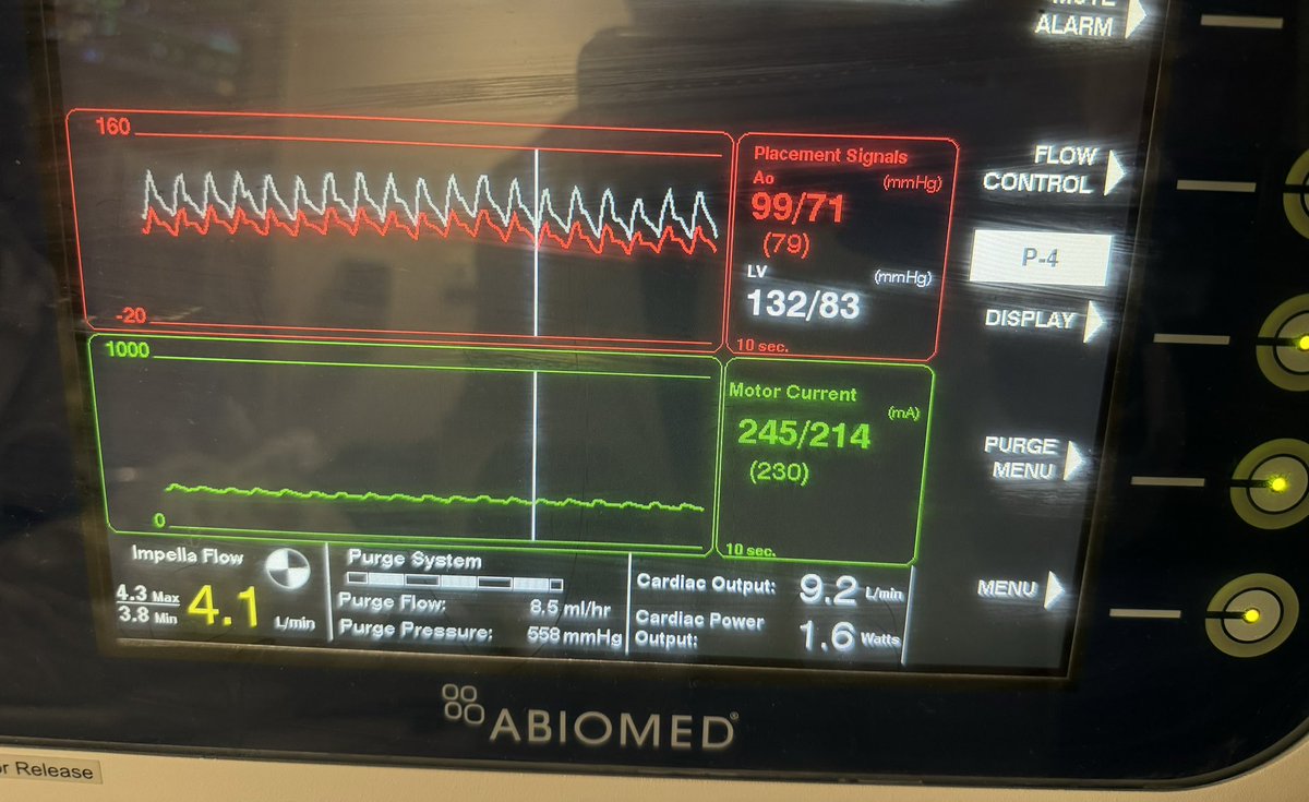 Ricky Hansra, MD 🫀 (@rickyhansra) on Twitter photo This was an interesting alarm 🚨
❤️🔥Impella position unknown
❤️🔥POCUS showing adequate position
❤️🔥Pt is stable
<a href="/CicUdevices/">CICUdevices</a> <a href="/EMinMiami/">Tim Montrief</a> @vumccardsfit <a href="/carlosalviar/">Carlos L. Alviar MD, FACC</a> <a href="/AnnGageMD/">Ann Gage</a> <a href="/PittCardiology/">Pitt Cardiology</a> <a href="/PittCCM/">Pitt Critical Care Medicine</a> This was an interesting alarm 🚨
❤️🔥Impella position unknown
❤️🔥POCUS showing adequate position
❤️🔥Pt is stable
<a href="/CicUdevices/">CICUdevices</a> <a href="/EMinMiami/">Tim Montrief</a> @vumccardsfit <a href="/carlosalviar/">Carlos L. Alviar MD, FACC</a> <a href="/AnnGageMD/">Ann Gage</a> <a href="/PittCardiology/">Pitt Cardiology</a> <a href="/PittCCM/">Pitt Critical Care Medicine</a>
