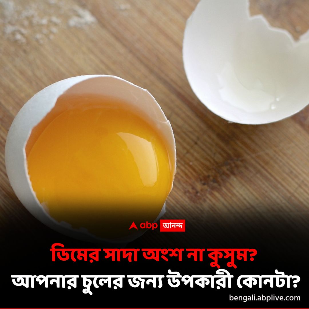 abpanandatv's tweet photo. চুলের স্বাস্থ্য বৃদ্ধিতে ডিম উপকারী, কীভাবে ব্যবহার করবেন?
#EggWhite #EggYolk #HairHealth #Lifestyle #ABPAnanda

বিস্তারিত পড়ুন: https://t.co/7u0ubM9sy9 https://t.co/Vok3qBNHRs