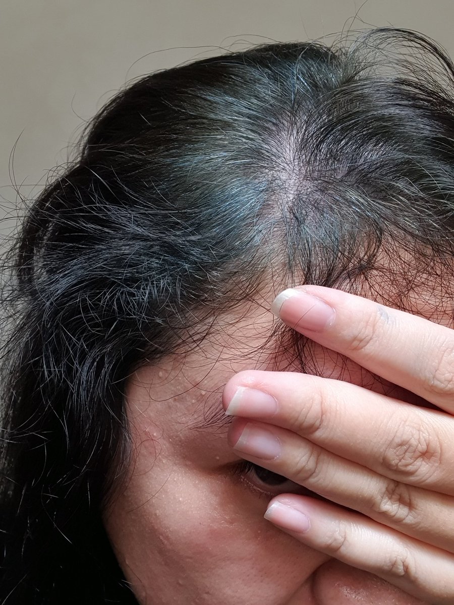 masharena_'s tweet photo. Jadi gini........

Pokoknya, ga usah lah iseng2 ya cat rambut kalo lg stress kata gue mah. Kembali lg dengan warna awut2an 🙏🥲🥲🥲

Uban2 gue warna biru, sisanya jd ijo dan ya udah gt aja. Sekian https://t.co/JU5UD2ApUQ