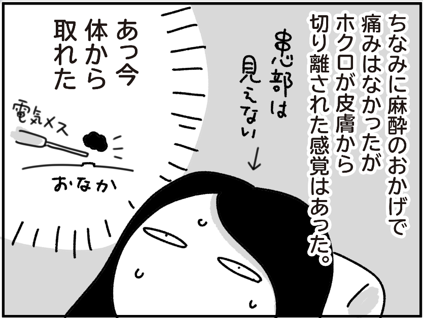 ブログ更新しました。ホクロの話はこれで終わりです。  ホクロを取った話 その3 - ちょっ子さん 