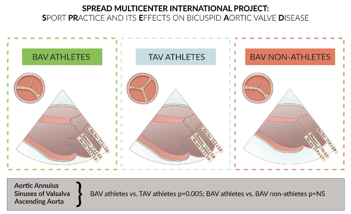 Flavio D'Ascenzi (@flaviodascenzi) on Twitter photo JUST PUBLISHED! Results of the international, multicenter registry on Sport PRactice and its Effects on aortic size and valve function in bicuspid Aortic valve Disease:
pubmed.ncbi.nlm.nih.gov/39153748/
@LunaCavigl59398 <a href="/BJSM_BMJ/">British Journal of Sports Medicine (BJSM)</a> #sportscardiologysiena #siena <a href="/AouSenese/">AouSenese</a> <a href="/unisiena/">Università di Siena</a> JUST PUBLISHED! Results of the international, multicenter registry on Sport PRactice and its Effects on aortic size and valve function in bicuspid Aortic valve Disease:
pubmed.ncbi.nlm.nih.gov/39153748/
@LunaCavigl59398 <a href="/BJSM_BMJ/">British Journal of Sports Medicine (BJSM)</a> #sportscardiologysiena #siena <a href="/AouSenese/">AouSenese</a> <a href="/unisiena/">Università di Siena</a>