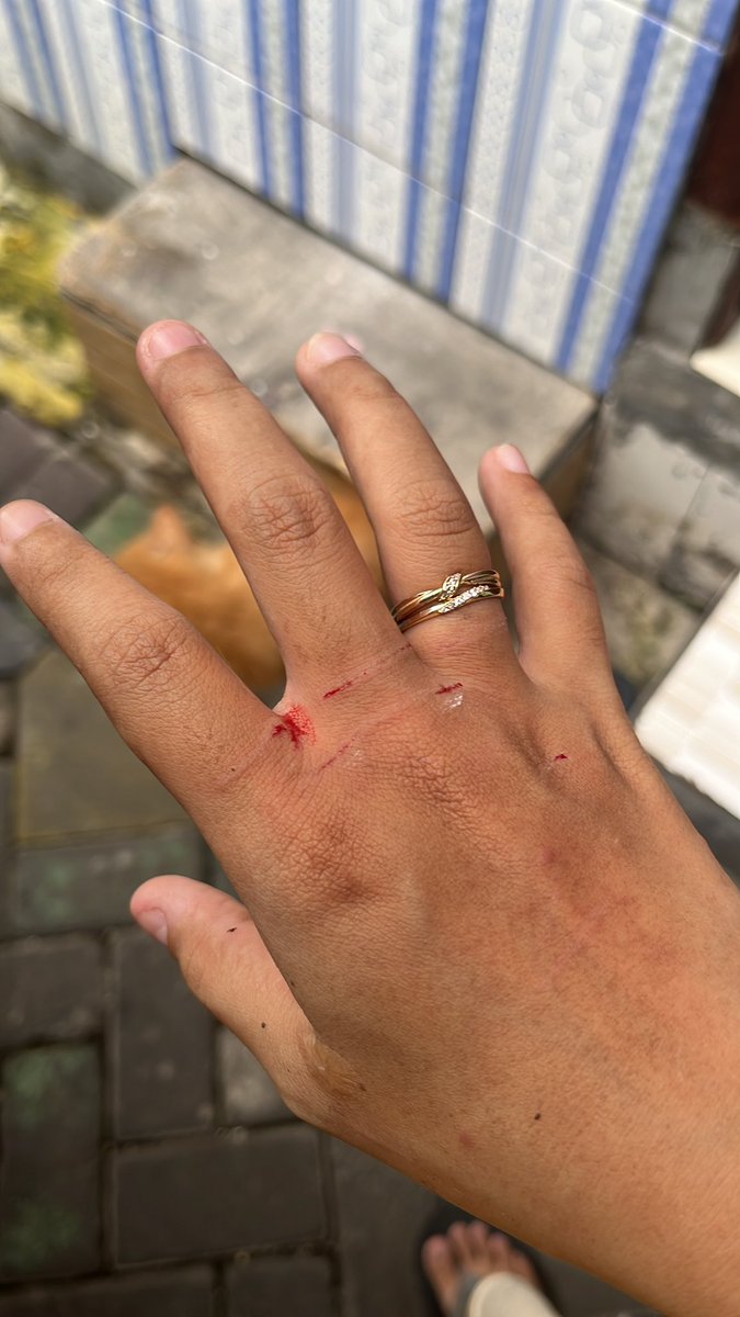 guggithecat's tweet photo. @JatIkhwan Digigit macam ni dah sakit kali https://t.co/9ALaBAzu44