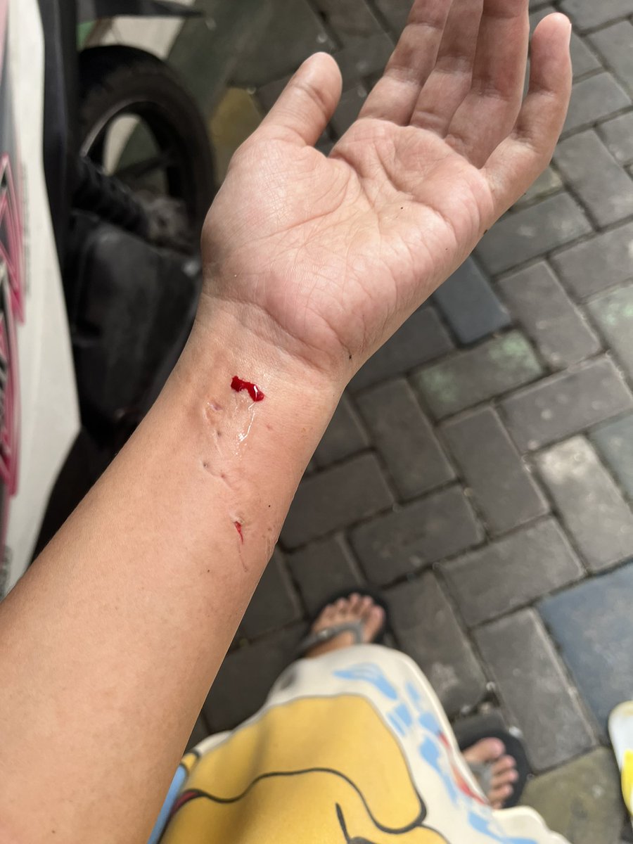 guggithecat's tweet photo. @JatIkhwan Digigit macam ni dah sakit kali https://t.co/9ALaBAzu44