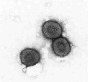 MONKEYPOX: cosa c’è da sapere di nuovo per essere informati…non preoccupati! A fornte delle tante notize sui media na news sul sito IZSLER riassume la situazione attuale in Italia e nel mondo
#izsler #OneHealth