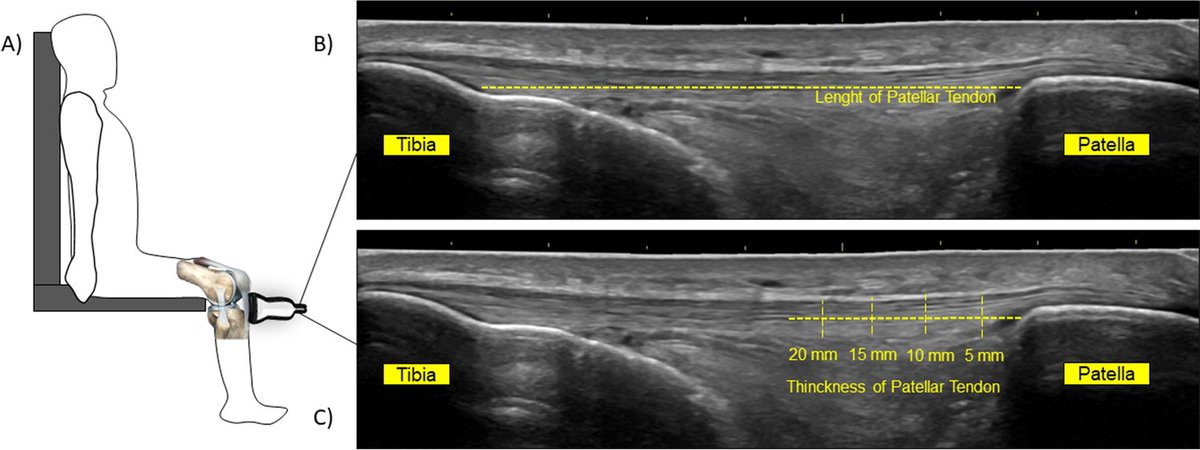 Journal Ultrasound tweet media
