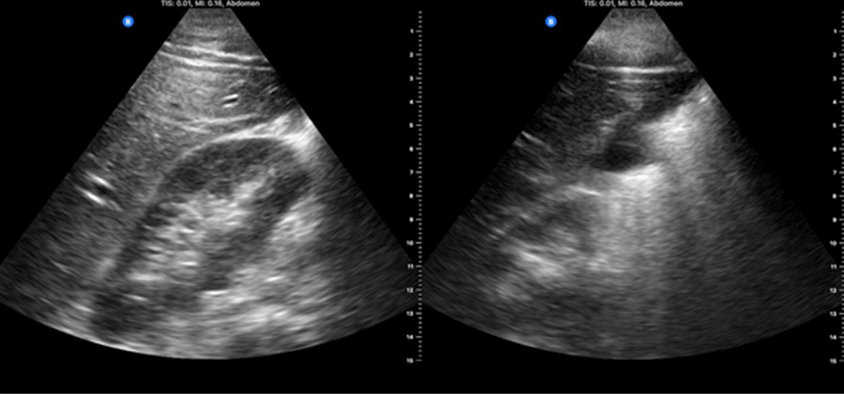 Journal Ultrasound tweet media