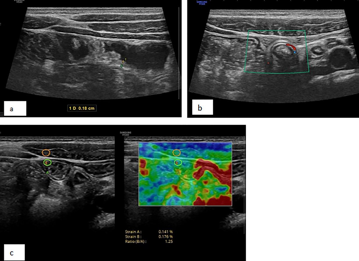 Journal Ultrasound tweet media