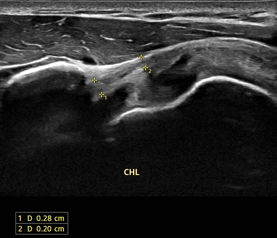 Journal Ultrasound tweet media