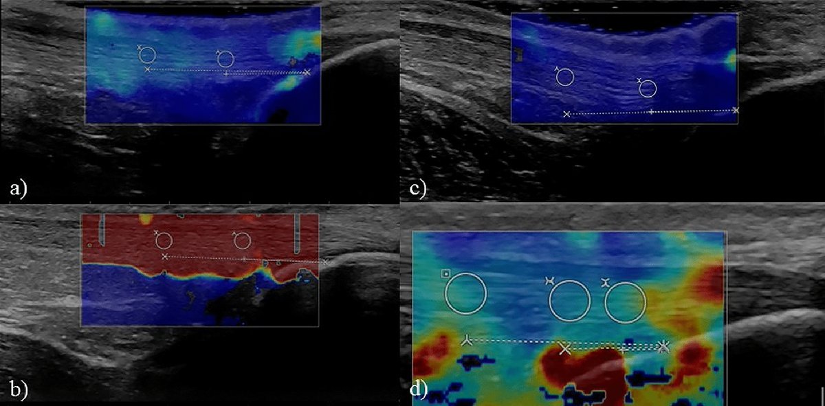 Journal Ultrasound tweet media