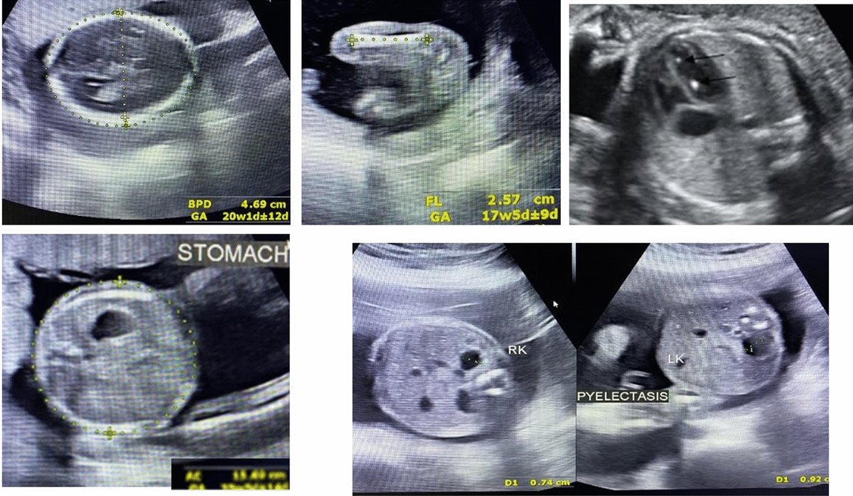 Journal Ultrasound tweet media