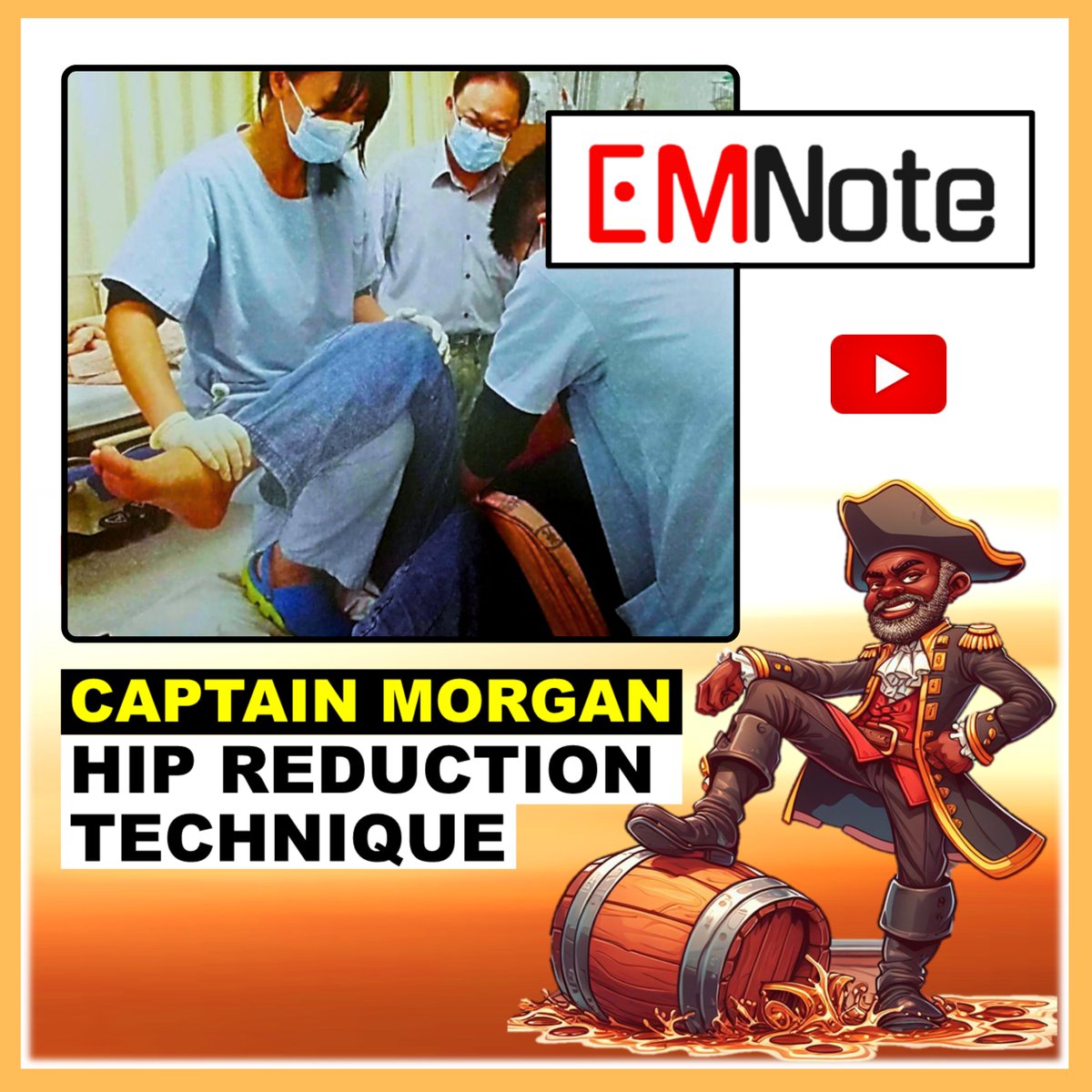 jackcfchong's tweet photo. 🦴Mastering the Captain Morgan technique for hip reduction!
https://t.co/60Oety96O0
With proper technique, you can reduce dislocations effectively while minimizing strain. Remember: safety first, practice makes perfect! #Orthopedics #HipDislocation https://t.co/QuImCF2ycV