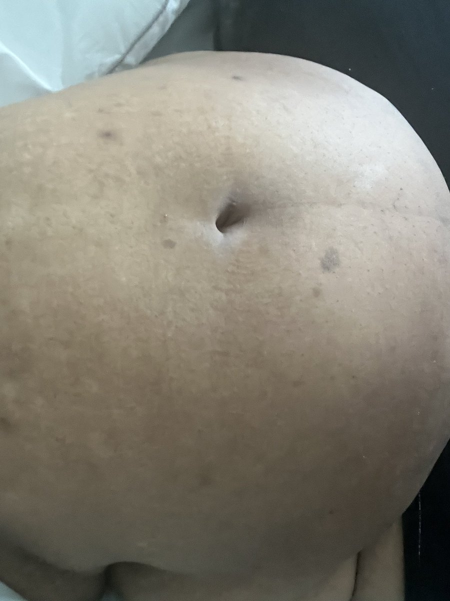 bubblybelly's tweet photo. Morning bloat https://t.co/iwBK3hkvpr